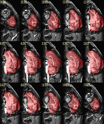 qc_02.input+mask.subjT1.sag