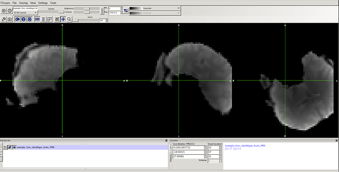 example_func_deoblique_brain_MNI