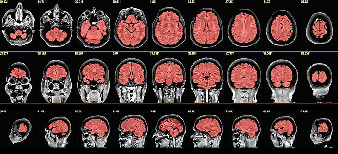 QC_anatSS.sub-000