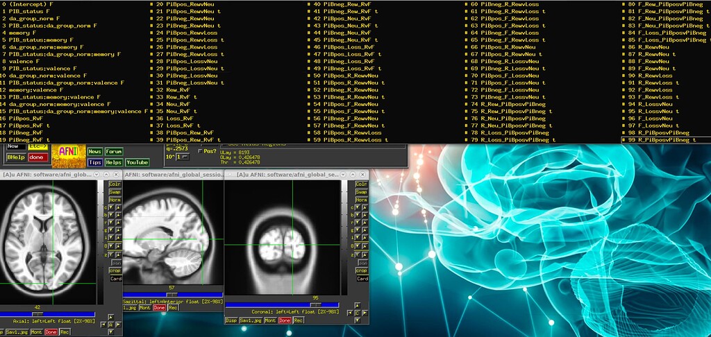 AFNI Viewer - Cannot view all overlay subbriks - AFNI Message Board ...