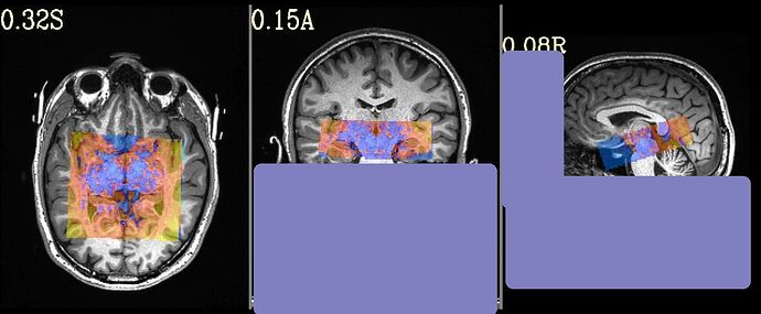 1d2d9015cfdddbf538dda46746b01be8d5f0209e_2