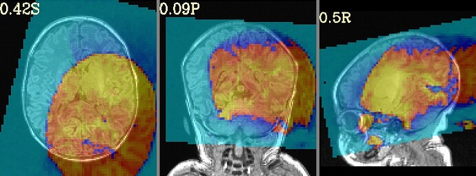 init_qc_00_overlap_usrc_obase_DEOB