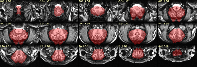 qc_02.input+mask.subjT1.axi