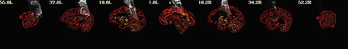 qc_03_ve2a_epi2anat.sag