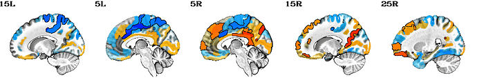 image_narps_hyp2_rba_alpha-Yes.sag