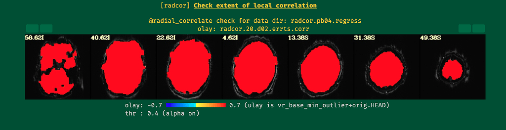 Unusual artifacts after including blur and censor - AFNI Message Board ...