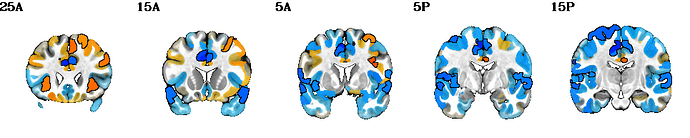 image_narps_hyp2_rba_alpha-Yes.cor