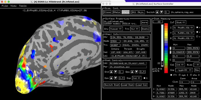 retinoprocdemo.png