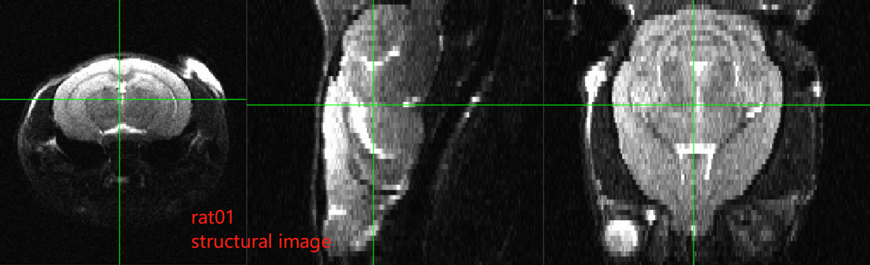 How to Rotate Mouse Brain MRI for quick AFNI Registration - AFNI 