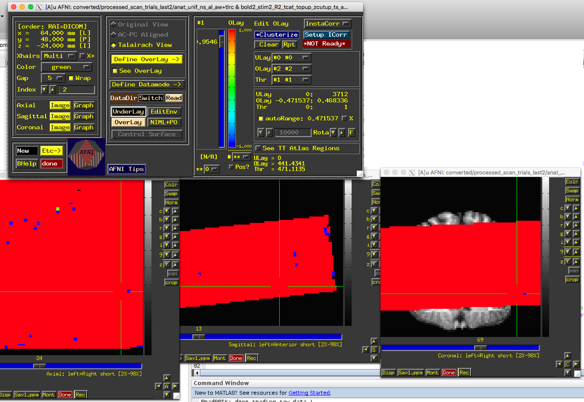 overlay-values-are-outside-the-range-of-possible-values-afni-message